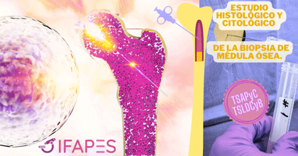 ESTUDIO HISTOLÓGICO Y CITOLÓGICO DE LA BIOPSIA DE MÉDULA ÓSEA